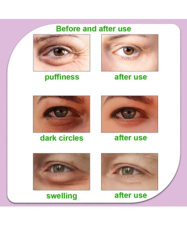 CONBELLA Gel Eye Cooling Pack - Reusable Hot Cold Pads for Eye Relaxation (2 Watermelons + 2 Cucumbers) - Buy Online on GoSupps.com