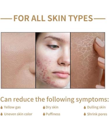 Rice Toner Rice Toner Korean Moisturizing Rice Water Toner Rice Water Bright Essence Toner Toner Skincare Hydrating Toner Rice Water Skin Toner Toner for Oily Skin Face Toner for Oily Skin Toner - Buy Online on GoSupps.com