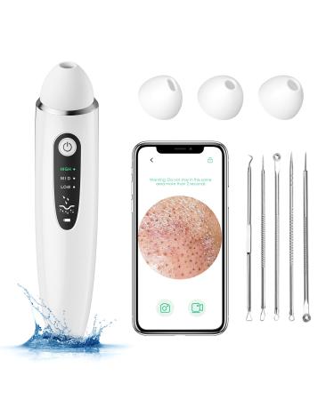 Blackhead Remover Pore Vacuum, 1080P WiFi Visible Facial Pore Ceaner, Skin Care Tool for Acne Pimples with 20X Magnification, Blackhead Extractor, Used for Extraction of Acne and Blackhead