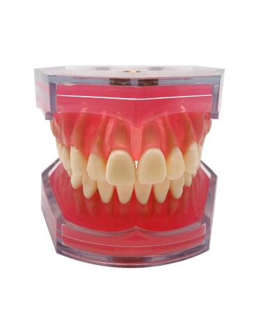 Standard Teeth Model Dental Crown Models Soft Gums Dental Model Resin Removable Full Mouth Teeth for Tooth Extraction Exercises Doctor Explains to The Patient