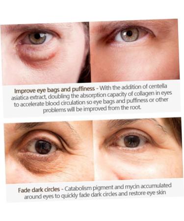 WOONEKY Recovery Bags Dark Circles Wrinkles Eye Cream Essence Moisturizing Brightening For - Buy Online on GoSupps.com