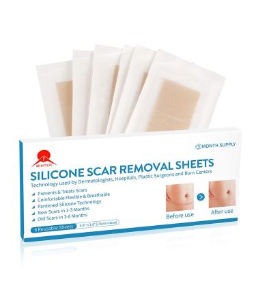 MT Healthy 6 Pcs Silicone Scar Removal Sheets (5.9 1.6) (3 Months Supply) Reusable Washable Silicone Scar Sheet Comfortable Painless Easy Removal for Hypertrophic Scars and Keloids