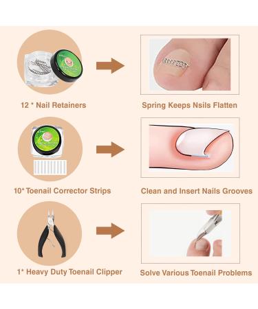 107PCS Ingrown Toenail Removal Kit - Toe Nail Corrector Tool for Pain Relief & Correcting Ingrown Toenails - Buy Online on GoSupps.com