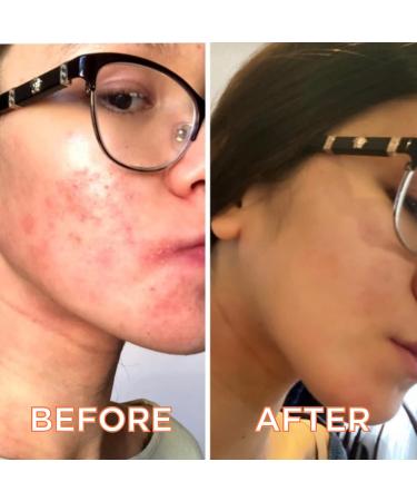 FATCO Organic Myrrhaculous Anti-Aging Face Cream with Tallow & Myrrh - Lavender + Myrrh (1 oz) | Natural Moisturizer for Youthful Skin - Buy Online on GoSupps.com