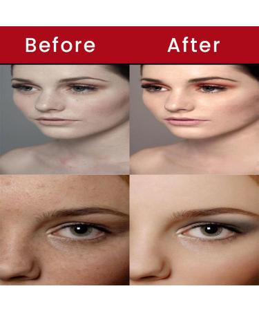 Retinol Pro Gel 0.05 (35 Gram / 1.23 Oz) Retinol Pro Gel-0.05 - Buy Online on GoSupps.com