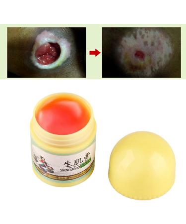 Bed Sore Cream 10g (2PCS) - Faster Healing & Infection Protection Ointment for Bed Sores - Buy Online on GoSupps.com