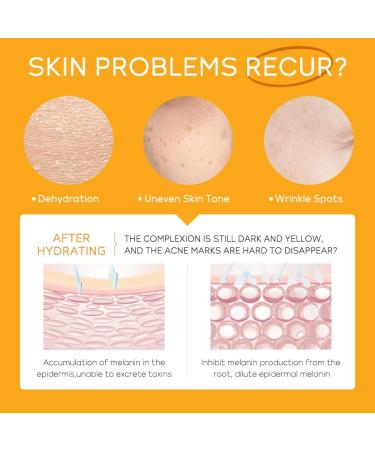 Shop Vitamin C Skincare Set - 5pcs Moisturizing Face Kit | Hydrating Anti-Aging Cleanser Serum & Cream | International Shipping - Buy Online on GoSupps.com