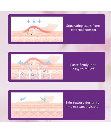 Silicone Scar Tape Roll - Professional Scar Removal Strips - 6 Month Supply - Medical Grade Treatment for C-Section, Burn, Keloid, Acne - Reusable & Effective - Buy Online on GoSupps.com