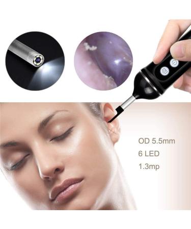 KANDUO Ear Curette Ear Cleaner with Camera Earwax Remover Tool with 500 Megapixel HD Ear Camera 6 Low-Temp LED Lights Ear Cleaner with LCD Screen for Kids Adults - Buy Online on GoSupps.com