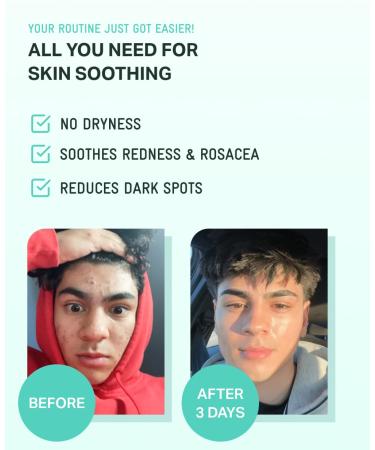 BRING GREEN ZINC TECA Serum with Niacinamide | Soothing Face Serum for Sensitive Skin Pore Minimizing & Hydrating | Korean Skincare for Breakouts & Uneven Texture Tea Tree 0.85 Fl Oz (Pack of 1) - Buy Online on GoSupps.com