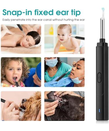 Wireless Ear Wax Removal Tool Camera | 1296p Visual Otoscope with Lighted Endoscope | Rechargeable Smart Earwax Remover Kit with 5 Spoons | White - Buy Online on GoSupps.com