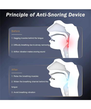 Smart Adjustable Anti Snore Device | USB Rechargeable Electric Snoring Stopper with Double Eddy Current Fan Design - Buy Online on GoSupps.com