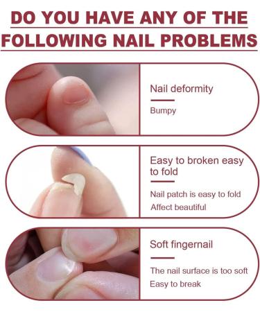 Maxlaser 2Sets Cracked Nail Repair Gel Instant Nail Repair Protection Gel ail Repair Kit for Cracked Natural Nails Nail Strengthener Nail Repair Gel for Nail Lengthening and Fiberglass - Buy Online on GoSupps.com
