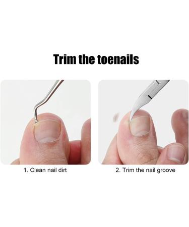 Toenail Nipper Toenail Clippers Professional with Toenail Lifter for Foot Nail Treatment for Thick Toenails - Buy Online on GoSupps.com