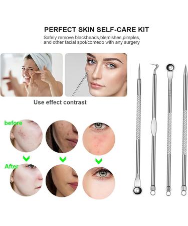 HudiMsat Blackhead Remover Pimple Comedone Extractor Tool Acne Removal Kit Zit Removing for Risk Free Nose Face Skin with Case 4PCS silvery - Buy Online on GoSupps.com