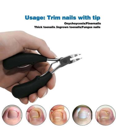 Precision Toenail Clippers Nail Clippers Trimmer for Thick or Ingrown Toenails Fingernail Clipper Surgical Grade Stainless Steel for Ingrown & Thick Nail (Black) - Buy Online on GoSupps.com