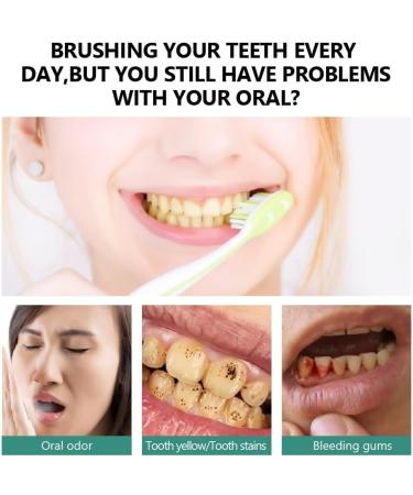 Probiotics Bright Whitening Teeth Mousse - 2025 Premium Herbal Whitening Foam for Deep Stain Removal | 3 Piece Oral Care Set - Buy Online on GoSupps.com