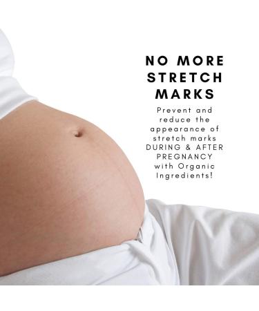 Irene Organics Belly Oil for Pregnancy Stretch Marks - Fast Absorbing & Hydrating 4oz - Buy Online on GoSupps.com