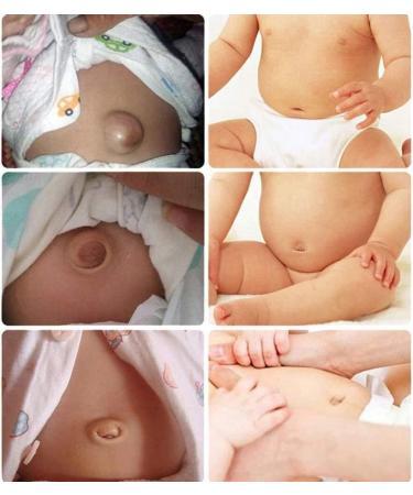 Samnuerly Adjustable Baby Navel Fracture Girdle - Hernia Support Truss with 3 Removable Compression Pads - Buy Online on GoSupps.com