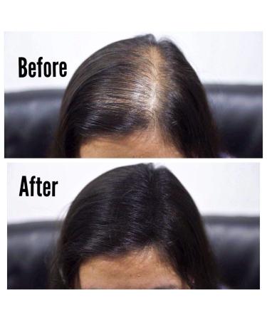 THICK FIBER Hair Building Fibers for Thinning Hair & Bald Spots (BLACK) - 25g Bottle - Instantly Conceals Hair Loss - Men & Women - 0.88oz - Buy Online on GoSupps.com