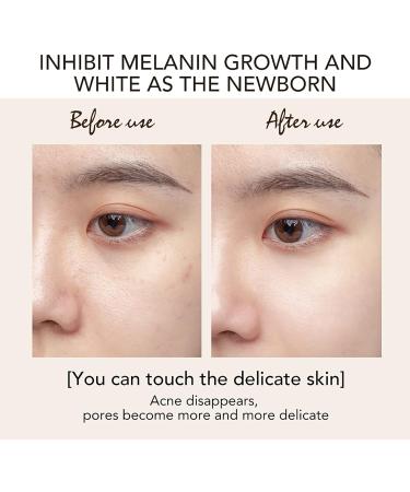 AILKE Kojic Acid Brightening 3 In 1 Face Care Set Blemishes Treatment Inhibit Melanin With SPF35+ Sunscreen Cream For All Skin Types - Buy Online on GoSupps.com