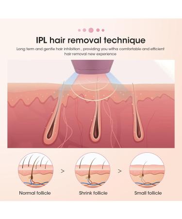 IPL Hair Remover Mini Home Laser - 500,000 Flashes, 5 Energy Gears - Portable & Lightweight - Rose Gold - Gifts for Women and Men - Buy Online on GoSupps.com
