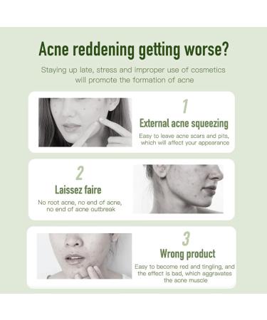 Anti Acne Removal Cream Tea Tree Acne Removal Gel Acne Cream for Acne Treatment & Spot Treatment Clear Soothing Spot Gel Acne Moisturiser Whiteheads & Blackhead Remover Invisible Gel - Buy Online on GoSupps.com