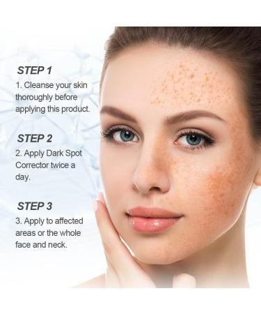 RADIANCE Dark Spot Corrector Serum | Arbutin Kojic Acid Vitamin C for Face & Body | Effective Melasma & Sun Damage Treatment for All - Buy Online on GoSupps.com