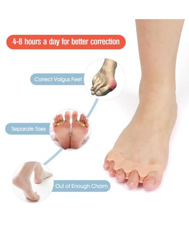 Buy Bunion Corrector & Relief Sleeve - Gel Pads for Men & Women | Fix Hallux Valgus & Restore Toe Shape - Buy Online on GoSupps.com