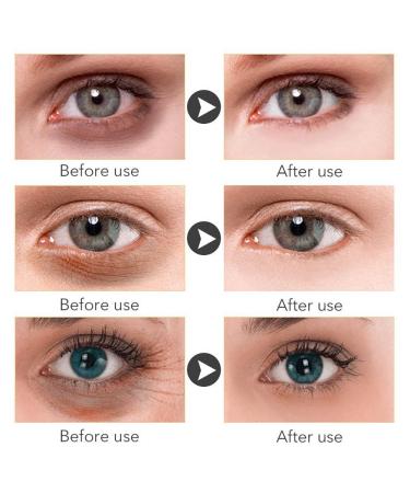 Magic Retinol Eye Cream for Dark Circles Puffiness and Bags Under Eyes Instant Results Firm Eye Tightener Anti Aging Under Eye Cream for Men Women Reduce Fine Lines Wrinkles and Age Spots - 1.06 Oz - Buy Online on GoSupps.com