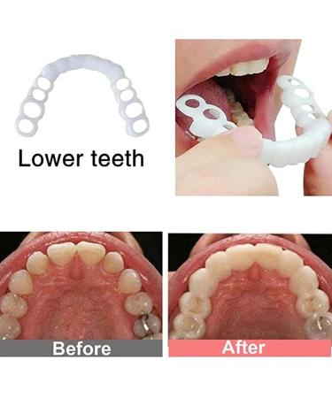 2 Pairs Adjustable Nature and Comfortable to Regain Confident Smile(White) Light Beige - Buy Online on GoSupps.com