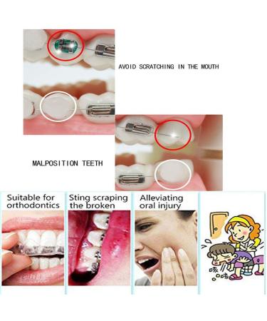 Dental Orthodontics Wax 6 Pack - Mint Scented Relief Wax for Braces - Gum Protection & Oral Care - Buy Online on GoSupps.com