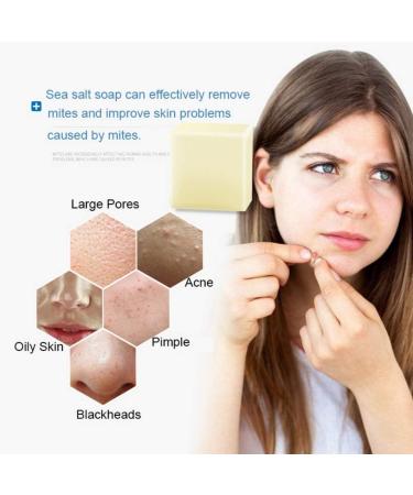Hocossy Mite Remove Soap Rich In Sea Salt Goat Facial Soap for Pimple Pores Repair Nourish Cleansing Personal Skin Care Product - Buy Online on GoSupps.com