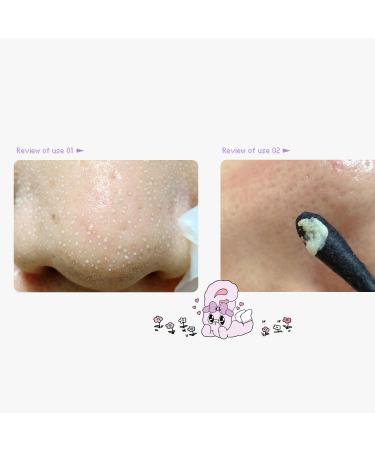 Ilso Natural Mild Clear Nose Patch - Melt Blackheads & Tighten Pores | Korean Skincare | 5 Sheets | Esther Bunny Limited Edition | No Irritation - Buy Online on GoSupps.com