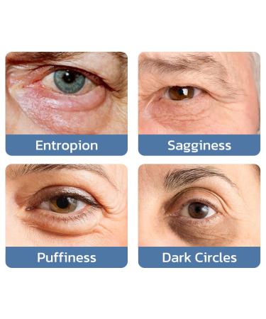 Lovilds & Openeyes Peptide Tight Eye Gel Rejuvenating Eye Lifting Gel for Men & Women (2PCs) Best International Shipping - Buy Online on GoSupps.com