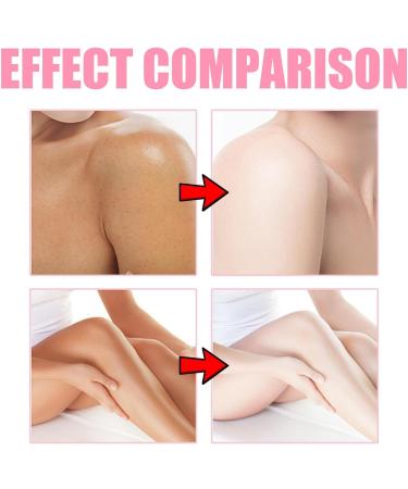 Whitening cream body lotion natural moisturizing body lotion body lotion for dry skin suitable for body and face suitable for body and face - Buy Online on GoSupps.com