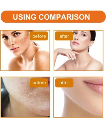 Orange Face Exfoliator Vitamin C Facial Scrub Gel Deep Exfoliating Face Wash Blackhead Scrub Orange Gel Face Scrub Brightening Skin Soft Your Skin and Remove Dead Skin For Smooth & Radiant 1 - Buy Online on GoSupps.com