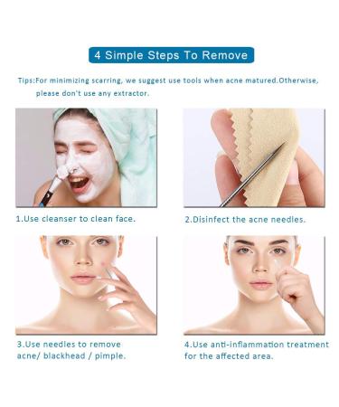 Ellolife 4-Pack Comedone Squeezer Set | Stainless Steel Blackhead Remover Kit for All Skin Types - Buy Online on GoSupps.com