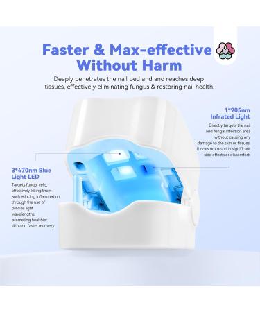 SAVILAND Nail Fungus Cleaning Device Faster: Max-Effective 905nm Infrared Light 470nm Blue Light Defeat Fungi Nail Fingernail Fungus Toenail Fungus Safer Painless Rechargeable Fungi Cure Home Use - Buy Online on GoSupps.com