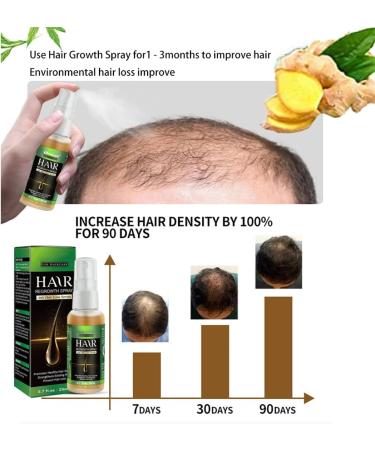  HADAVAKA Ginger Hair Growth Serum Hair Regrowth Spray Hair Growth Essential Oils Hair Serum Hair Nutrient Liquid Hair Conditioning Essential Oils Hair Growth Spray For Hair Care (1 pc) - Buy Online on GoSupps.com