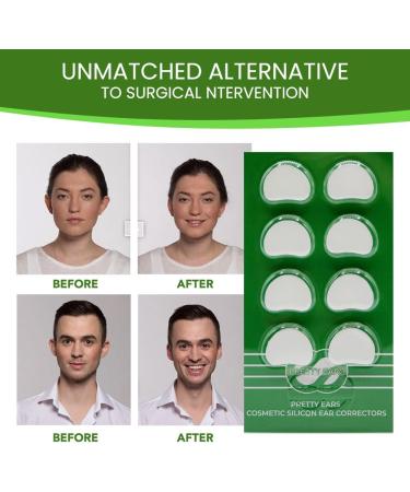 Cosmetic Ear Corrector for Adults | Transparent Silicone Tape for Protruding Ears | 4 Pairs - Non-Surgical Ear Solution - Buy Online on GoSupps.com