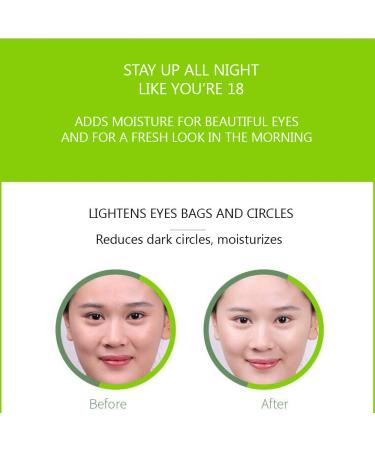 BIOAQUA Aloe Vera Eye Gel Cream 20g - Reduces Dark Circles, Hydrates, and Moisturizes | No More Eye Bags - Guaranteed - Buy Online on GoSupps.com