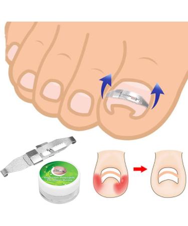 Brand Ingrown Toenail Corrector Stainless Steel Pencil Paronychia Treatment Tool for Foot Care - Buy Online on GoSupps.com