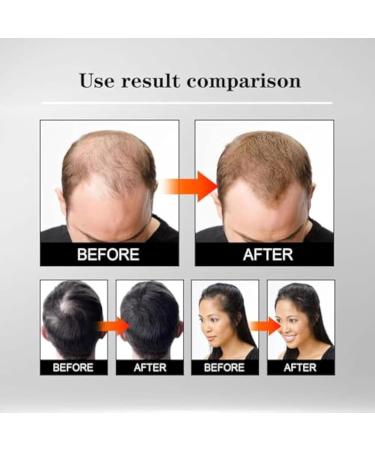 Hair Growth Oil | Daily Hair Care Treatment Hair Oil Care 5ml x 3 Set of Plant-Based Hair Growth Oil Moisturizing Nourishing the Scalp Contains - Buy Online on GoSupps.com
