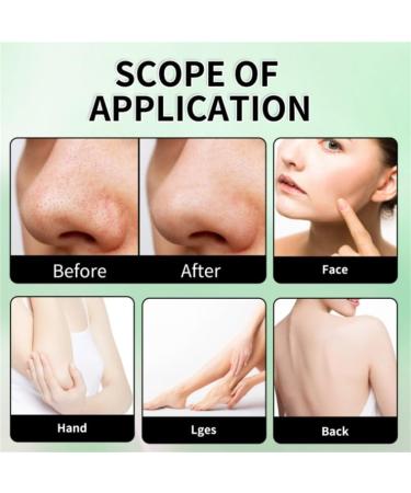 Creteam Gel Exfoliant Purifiant et Hydratant pour le Visage et le Corps - Nettoyage en Profondeur de la Peau (1 Pi ce) 1 pi ce. - Buy Online on GoSupps.com