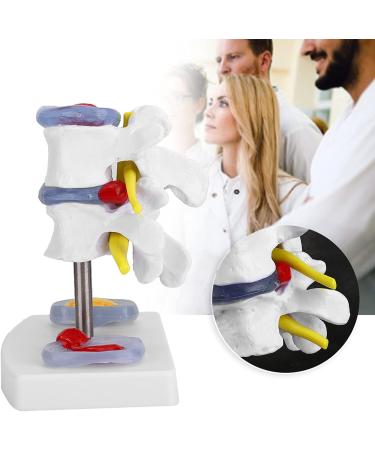 Anatomical Lumbar Intervertebral Disc Model - Spine Demonstration for Training & Education | International Shipping Available - Buy Online on GoSupps.com