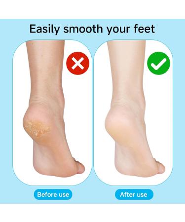 23 in 1 Professional Pedicure Manicure Tools Kit - Stainless Steel Foot Care Scrubber & Callus Remover for Women & Men | International Shipping Available - Buy Online on GoSupps.com