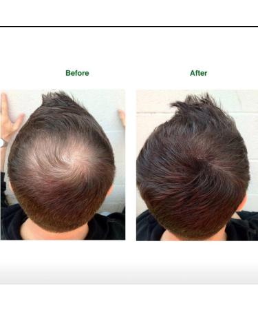 Topaxx Hair Building Fibers - Natural Hair Thickener for Men & Women - Black 0.97oz - Buy Online on GoSupps.com