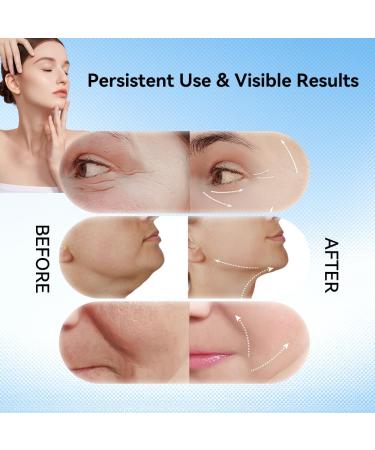 Neck Face Massager - 3-in-1 Facial Sculpting Tool with Vibration & Thermal Function | Portable Multifunctional Device (White) - Shop Now - Buy Online on GoSupps.com