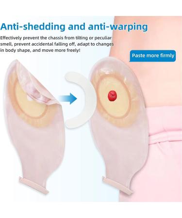 Ostomy Supplies Skin Barrier Strips | Colostomy Bag Skin Extender Strips (20 pcs) | Waterproof Hydrocolloid Half Rings - Buy Online on GoSupps.com